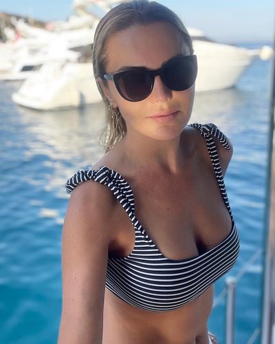 Ece Erken seksi ifşa fotoğrafı 30