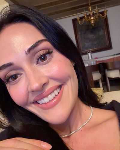 Esra Bilgiç seksi ifşa fotoğrafı 887