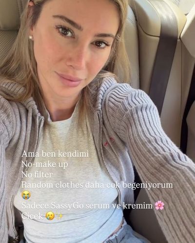 Şeyma Subaşı seksi ifşa fotoğrafı 1183